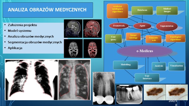 polska-tomografia17